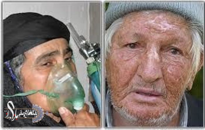 سالگرد حمله شیمیایی رژیم بعثی عراق به روستاهای کرمانشاه